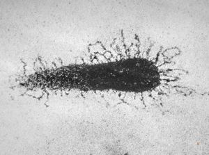 F,7y. | glycocalyx on microvillus - nasal mucosa